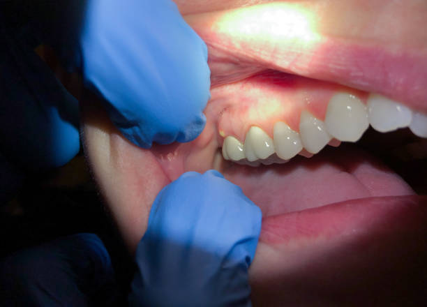 Best Pediatric Emergency Dentist in Three Way, TN