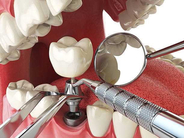Best Emergency Cosmetic Dentistry in Three Way, TN