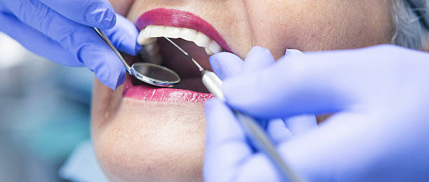 Best Emergency Root Canal Treatment in Three Way, TN